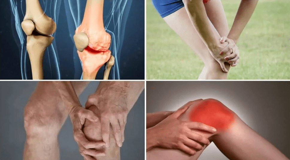 Symptômes d'arthrose